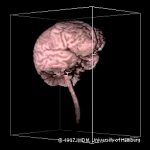 Première reconstruction 3D d'un cerveau à partir d'une IRM