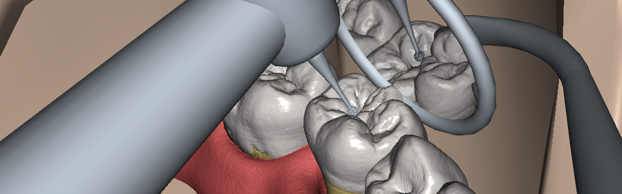 Comparer les simulateurs VOXEL-MAN Dental