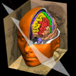 VOXEL-MAN Cerveau et Crâne atlas 3D